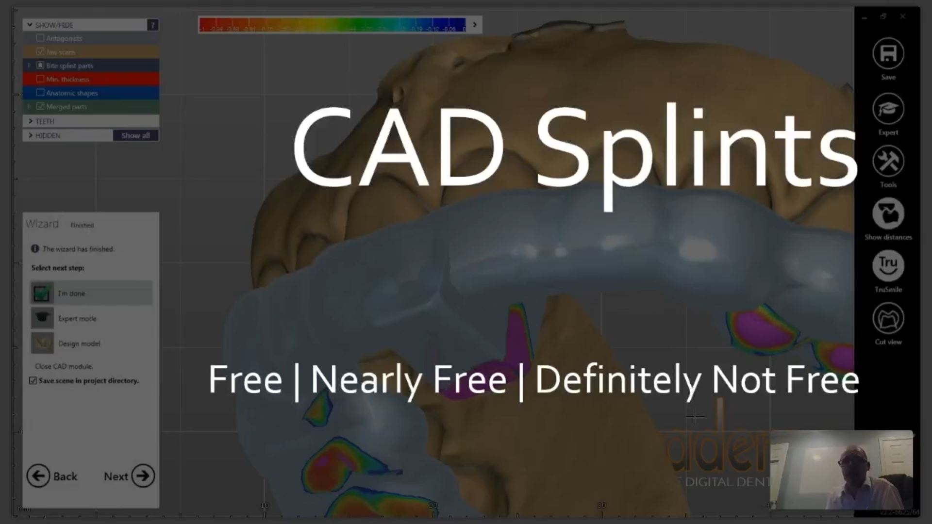 2018-08-25 06_58_22-Weekly Webinar 06 - 2018-08-23 - All About Splints on Vimeo